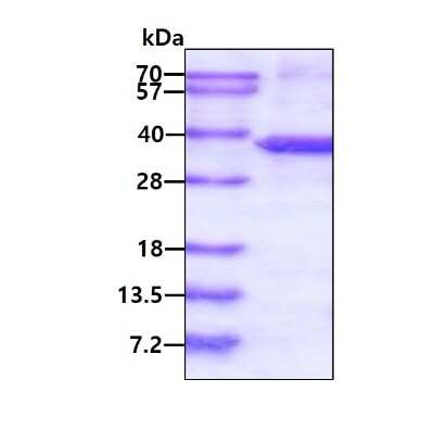 SDS-Page: Recombinant Human ST3GAL5 His Protein [NBP2-22824] - 3ug by SDS-PAGE under reducing condition and visualized by coomassie blue stain.